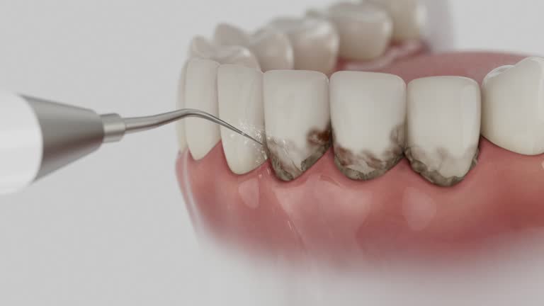 Reliable Teeth Whitening contractor in St. Bernard Parish County, LA by Dentist Open Now